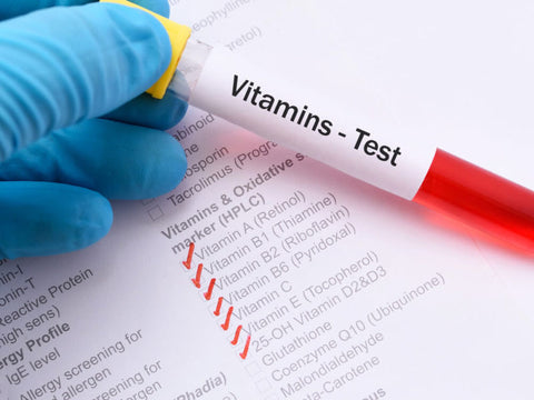 Vitamin Test